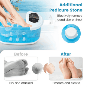 Foot Spa Bath Massager w/ Heat, Bubbles & Vibration Mode, Digital Temp Control, 12 Rollers, Pedicure Stone, Foot Soaker Tub for Relaxation
